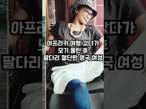 아프리카 여행갔다가 모기 물린 후 팔, 다리를 절단한 이유